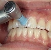 サンプルイメージ